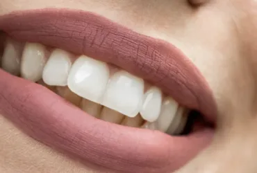 The Ultimate Guide to Oral Wellness