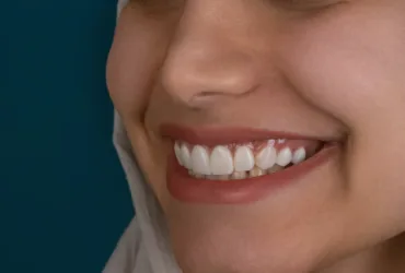 The Ultimate Guide to the Best Dental Clinics in New York City