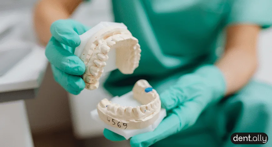 What Are All-on-Six Dental Implants? Procedure, Costs, and Benefits (2026 Expert Guide)