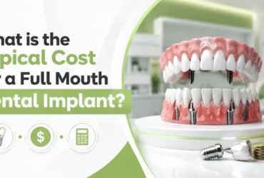 What is the Typical Cost for a Full Mouth Dental Implant?