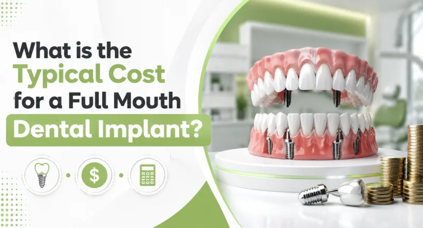 What is the Typical Cost for a Full Mouth Dental Implant?